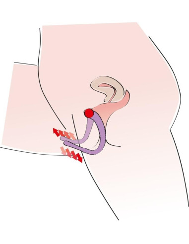 Intimate Spreader Purple acquista online su Porky's Store